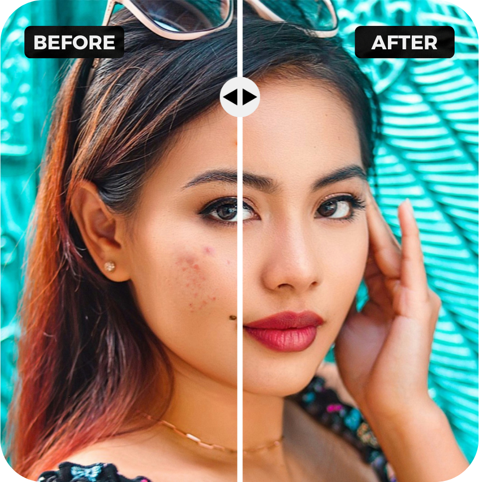 Blemish Remover Tool blemish-remover-tool